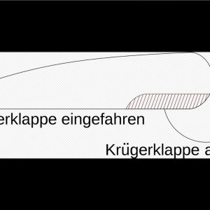 Folge 87: Vorteil von Krueger Flaps